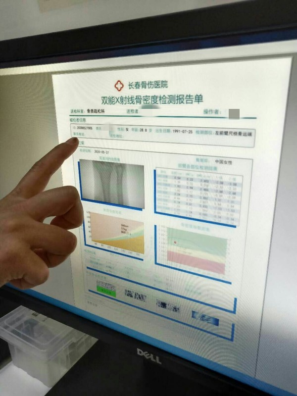 品源雙能X射線骨密度儀落戶吉林省長春骨傷醫(yī)院，助力骨松診療