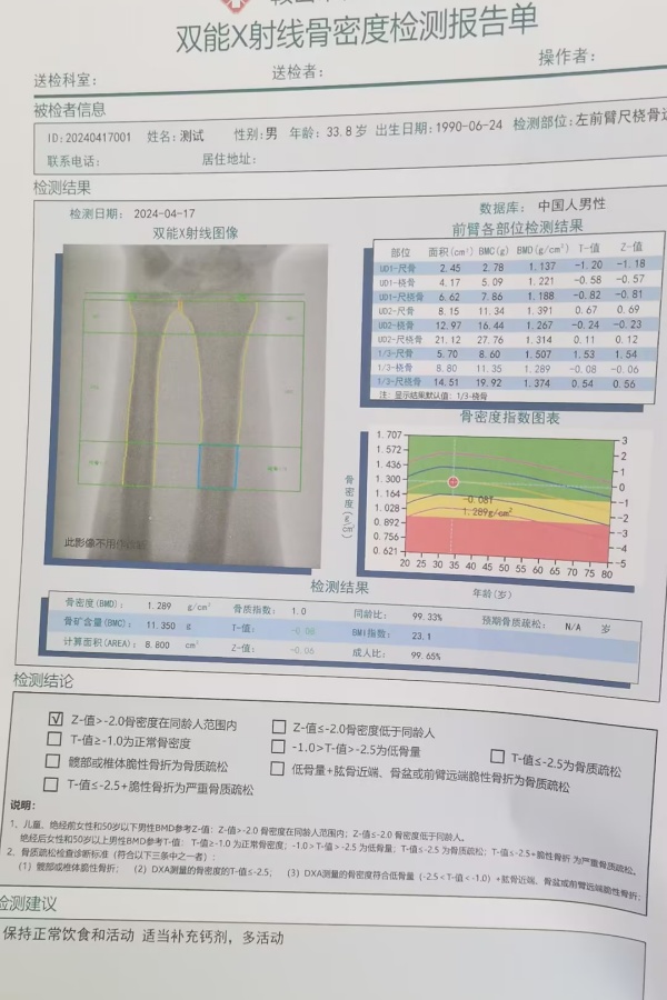 雙能X射線骨密度儀：準(zhǔn)確測量骨密度，助力骨質(zhì)疏松防治，守護(hù)骨骼健康